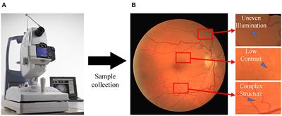 MFA-UNet: a vessel segmentation method based on multi-scale feature fusion and attention module
